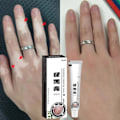 Miniatyrbillede 2 af 6: Effektivt vitiligo reparation salve urte fjernelse ringorm hvid plet creme fjern få kvit af hud