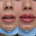 Miniatyrbillede 3 af 8: Læbe Plump Serum Forøg Læbe Elasticitet Øjeblikkelig Volumiserende Esentiel Olie Reducer Fine Linjer Reparation