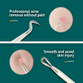 Miniatyrbillede 2 af 6: Acne Fjerner Nåle Hormhoved Fjernelse Bums Extractor Set