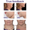 Miniatyrbilde 4 av 4: Face Cream Double chin elimination V Line Products