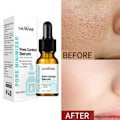 Miniatyrbillede 2 af 6: Pore Shrinking Ansigt Serum Fjerner Hormehoveder Mørke Pletter Acne Behandling Olie Kontrol Fugtgivende
