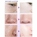 Miniatyrbillede 4 af 7: Pore Shrinking Serum Shrink Porer Cream Lactobionic Acid Shrink Pores Serum