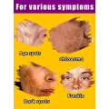 Miniatyrbillede 3 af 3: Mørk Plet Fjerner Melasma Chloasma Fregner Plet Fjernelse Creme
