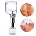 Miniatyrbillede 3 af 5: 4 stykker Hjerteformet Cupping Device Set Moderig Vacuum Suge Dåser Drive Out Fugt Massage Terapi