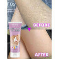 Miniatyrbilde 2 av 6: Pilaris Behandling Jordbær Bein Fjerning Bumpy Rough Kylling Skin Fjerner Cream