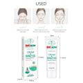 Miniatyrbillede 4 af 7: Acne Behandling Creme Pore Shrink Olie Kontrol Hviding Reparation Bums Dyb rengøring Anti-acne Fugtighedscreme