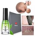 Miniatyrbillede 2 af 4: Hudorme Fjerner Ansigt Næse Maske Pore Strip Sort Maske Peeling Acne Behandling Deep Cleansing Maske