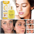 Pikkukuva 3 / 5: Tumman täplän poistoaine kasvoille aurinko melasma pisamia pigmentti ikä täplät poisto