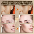 Miniatyrbilde 4 av 6: Effektiv porer fjerner pore krympe serum krympe oppstramming minimering