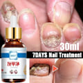 Miniatyrbillede 4 af 5: Reparation Negle Svamp Behandling Essence Fod Pleje Serum Tå Negle Svampe Fjernelse Gel
