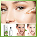 Miniatyrbillede 5 af 5: Fregner fjernelse essens fjern ansigtsbehandling pletter hud mørk plet fjern melasma pletter solpletter hvidning og fregne fjernelse creme