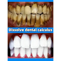 Miniatyrbillede 3 af 5: tand tandsten fjerner blegning tænder mund lugt fjernelse dårlig ånde Forebyggelse Periodontitis