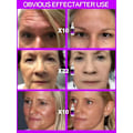 Miniatyrbilde 3 av 5: Effektiv Anti-aldring Anti-rynke Ansiktsbehandling Serum Fjerner Ansikts Rynker Fine linjer