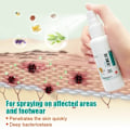 Miniatyrbillede 4 af 7: Urte Athlet Fod Anti-svampe Spray Fjern Fod Lugt Beriberi Kløe Fod Pleje Reparation Tå