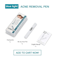 Miniatyrbillede 6 af 6: Blå Lys Ansigtsbehandling Maskin Acne Rynke Fjernelse Laser Pen Hud Pletter Fjernelse Anti Skrampe Spider Vene Eraser