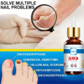 Miniatyrbillede 3 af 5: Reparation Negle Svamp Behandling Essence Fod Pleje Serum Tå Negle Svampe Fjernelse Gel