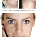 Miniatyrbillede 3 af 7: Ansigtsbehandling pletter hud mørk plet fjern melasma alder pletter solpletter hvidning og fregne fjernelse creme