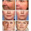 Miniatyrbild 2 av 6: Magic Wrinkle Remover Face Cream Anti-Aging Fade Fine Lines Lifting Firming Whitening Fuktgivande Skönhet Hudvård 50g