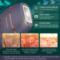 Miniatyrbilde 6 av 7: IPL Laser Epilator for Menn Kvinner 4 i 1 Fjerning Laser Epilator System Smertefri trimmer