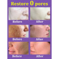 Miniatyrbilde 6 av 6: porer fjerner pore krympende serum krympe oppstramming minimering