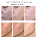 Miniatyrbillede 6 af 9: Blegning ansigt creme fjernelse rynker fregne fjernelse anti-acne behandling fade fine linjer