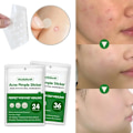Miniatyrbild 5 av 5: Acne Pimple Patch Osynlig Vattentät Absorbera Pus Acne Pimple Remover Verktyg Acne Cleaner