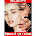 Miniatyrbillede 2 af 5: Effektiv anti-aging og anti-rynke ansigtsbehandling serum til fjerne ansigtsrynker