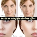 Miniatyrbillede 6 af 6: Instant Lift Collagen Protein Thread Set Face Filler Absorbable Thread Firming Silke Fibroin Line Carving Anti-aging Face Essence