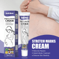 Miniatyrbilde 4 av 5: Stretch Mark Fjerning Cream White Stretch Mark Fjerner