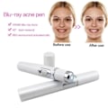 Miniatyrbillede 4 af 6: Blå Lys Ansigtsbehandling Maskin Acne Rynke Fjernelse Laser Pen Hud Pletter Fjernelse Anti Skrampe Spider Vene Eraser