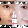 Miniatyrbild 2 av 4: Pore Minimizer Serum För Ansikte Pore Ansiktsbehandling Porförträngande Serum