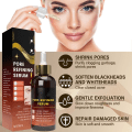 Miniatyrbilde 6 av 6: Effektiv porer fjerner pore krympe serum krympe oppstramming minimering