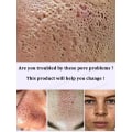 Miniatyrbilde 4 av 6: porer fjerner pore krympende serum krympe oppstramming minimering