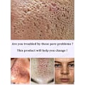 Miniatyrbillede 4 af 6: porer fjerner pore krympende serum krympe opstramning minimering