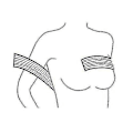 Miniatyrbild 3 av 5: Bröst Implantat Stabilisator och Bröstkompression Stödband Efter Operation, Bröstförstoring och -reducering Bandage, One Size Passar De Flesta, Hudfärgad