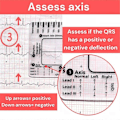 Miniatyrbild 4 av 5: 2 st EKG 7-stegs linjal, EKG 7-stegs linjal för EKG-tolkning, EKG-linjal, bärbar EKG-bedömningsverktyg EKG-kort