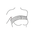 Miniatyrbild 4 av 5: Bröst Implantat Stabilisator och Bröstkompression Stödband Efter Operation, Bröstförstoring och -reducering Bandage, One Size Passar De Flesta, Hudfärgad