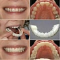 Miniatyrbild 5 av 5: Smile Knäpp på löständer Nedre och övre tandfasader Set Cover null none