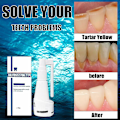 Miniatyrbild 2 av 3: 1-3 st Calculus Dissolving Spray Hushålls Calculus Remover For Fighting Tooth 30ml 1pc