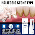 Miniatyrbild 3 av 3: 1-3 st Calculus Dissolving Spray Hushålls Calculus Remover For Fighting Tooth 30ml 1pc