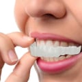 Pikkukuva 2 / 3: Snap On -väärät hampaat ylä- ja alahampaiden hammasviiluihin hammasproteesien hammaspeite sarja A Only Upper teeth