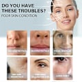 Miniatyrbillede 3 af 5: 60 stk Hudstrammende Collagen Tråde Uden Nåle Ansigts Tråd Udskåret Protein Linje Anti-Aging Rynkefjernelse Skønhedspleje Produkter