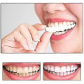 Miniatyrbilde 5 av 5: Snap On Teeth Veneers, perfekte midlertidige erstatninger for tenner