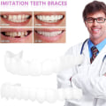 Miniatyrbilde 4 av 5: Snap On Teeth Veneers, perfekte midlertidige erstatninger for tenner