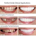 Miniatyrbild 5 av 5: 2 st Snap On Smile Övre Falska Tänder Tand Veneers Protes Set