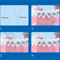 Miniatyrbilde 4 av 10: Tanntrådtrådere Dental Traction BLÅ