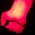 Miniatyrbillede 3 af 4: Infrarød vene-imaging rød lygte lommelygte pædiatrisk enhed klinikere sygeplejersker vene finder