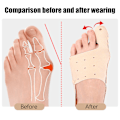Miniatyrbild 2 av 7: Bunion Corrector för Hallux Valgus, Justerbar Tåriktare M