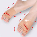 Miniatyrbild 3 av 4: Bunionkorrigerare för Hallux Valgus, Andningsbar Bunionskena för Tåriktning & Bunionlindring S