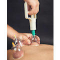 Miniatyrbillede 5 af 5: INF Cupping med vakuumpumpe til behandling og massage 12 stk